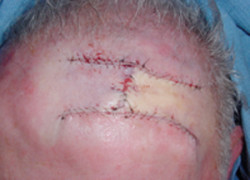 Reconstructive Surgery