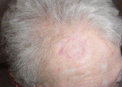 Reconstructive Surgery