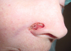 Reconstructive Surgery