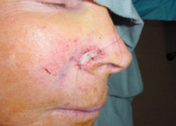 Reconstructive Surgery