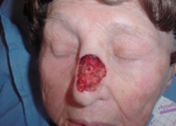 Reconstructive Surgery