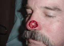 Reconstructive Surgery