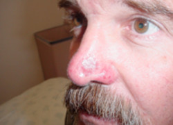 Reconstructive Surgery