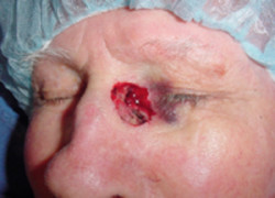 Reconstructive Surgery