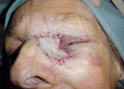 Reconstructive Surgery