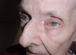 Reconstructive Surgery