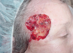 Reconstructive Surgery