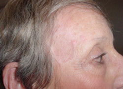 Reconstructive Surgery