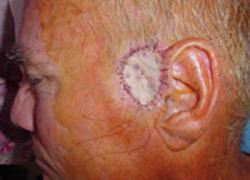 Reconstructive Surgery