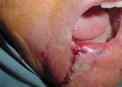 Reconstructive Surgery