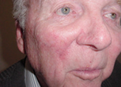 Reconstructive Surgery