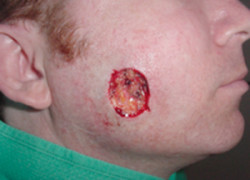 Reconstructive Surgery