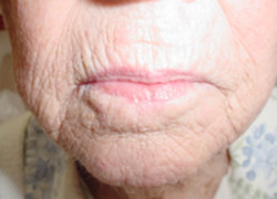 Reconstructive Surgery