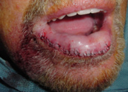 Reconstructive Surgery