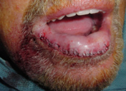 Reconstructive Surgery