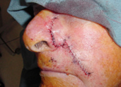 Reconstructive Surgery