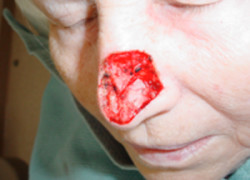 Reconstructive Surgery