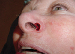 Reconstructive Surgery