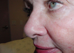 Reconstructive Surgery