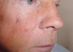 Reconstructive Surgery