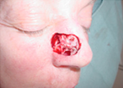 Reconstructive Surgery