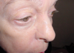 Reconstructive Surgery