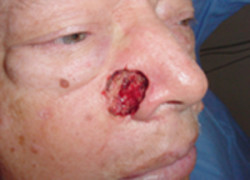 Reconstructive Surgery