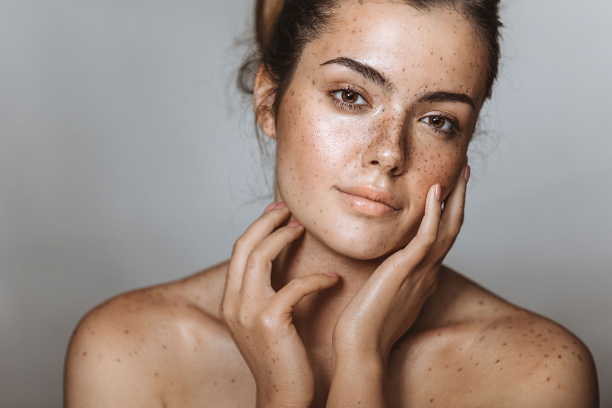 skin cancer moles on arms